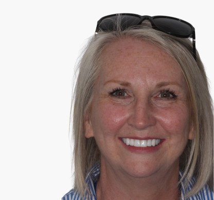 Dental Implants Glasgow