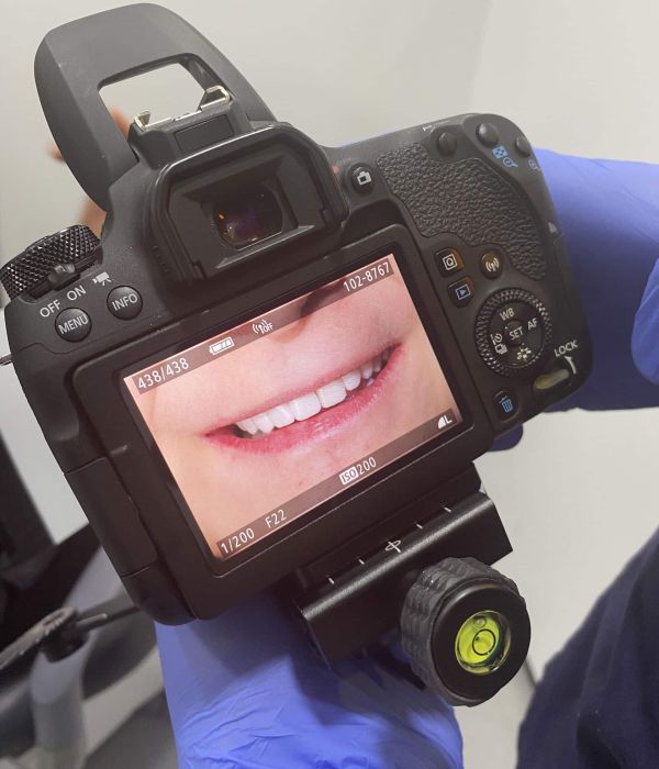 camera pt teeth camera pt teeth